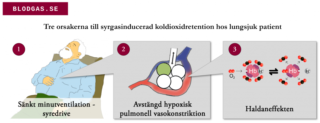 Tre orsakerna till syrgasinducerad koldioxidretention hos lungsjuk patient
